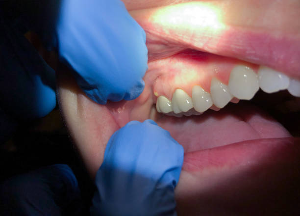 Best Emergency Treatment for Toothache in Brooks, KY