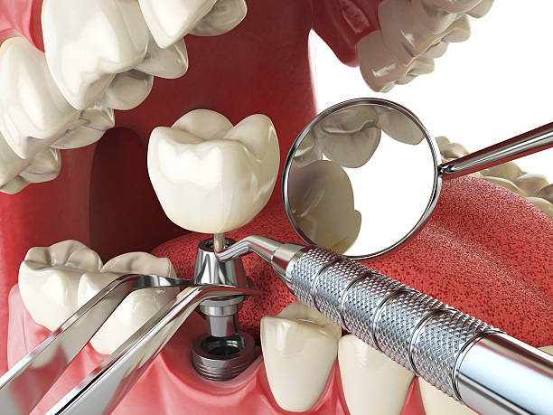 Best Walk-In Emergency Dentist in Brooks, KY